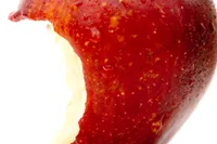 即時埋入インプラント